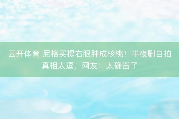 云开体育 尼格买提右眼肿成核桃！半夜删自拍真相太逗，网友：太确凿了